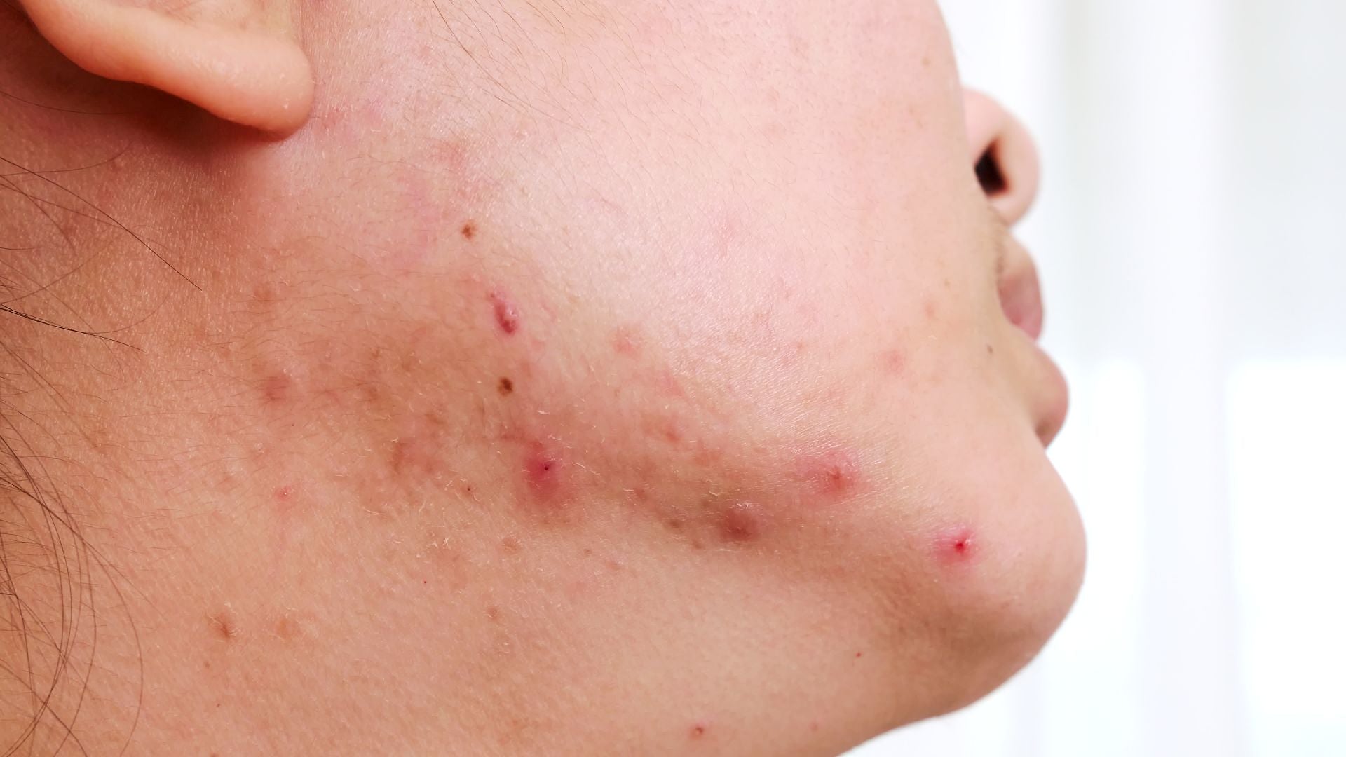 Revive Collagen vs Benjamin Button: 
